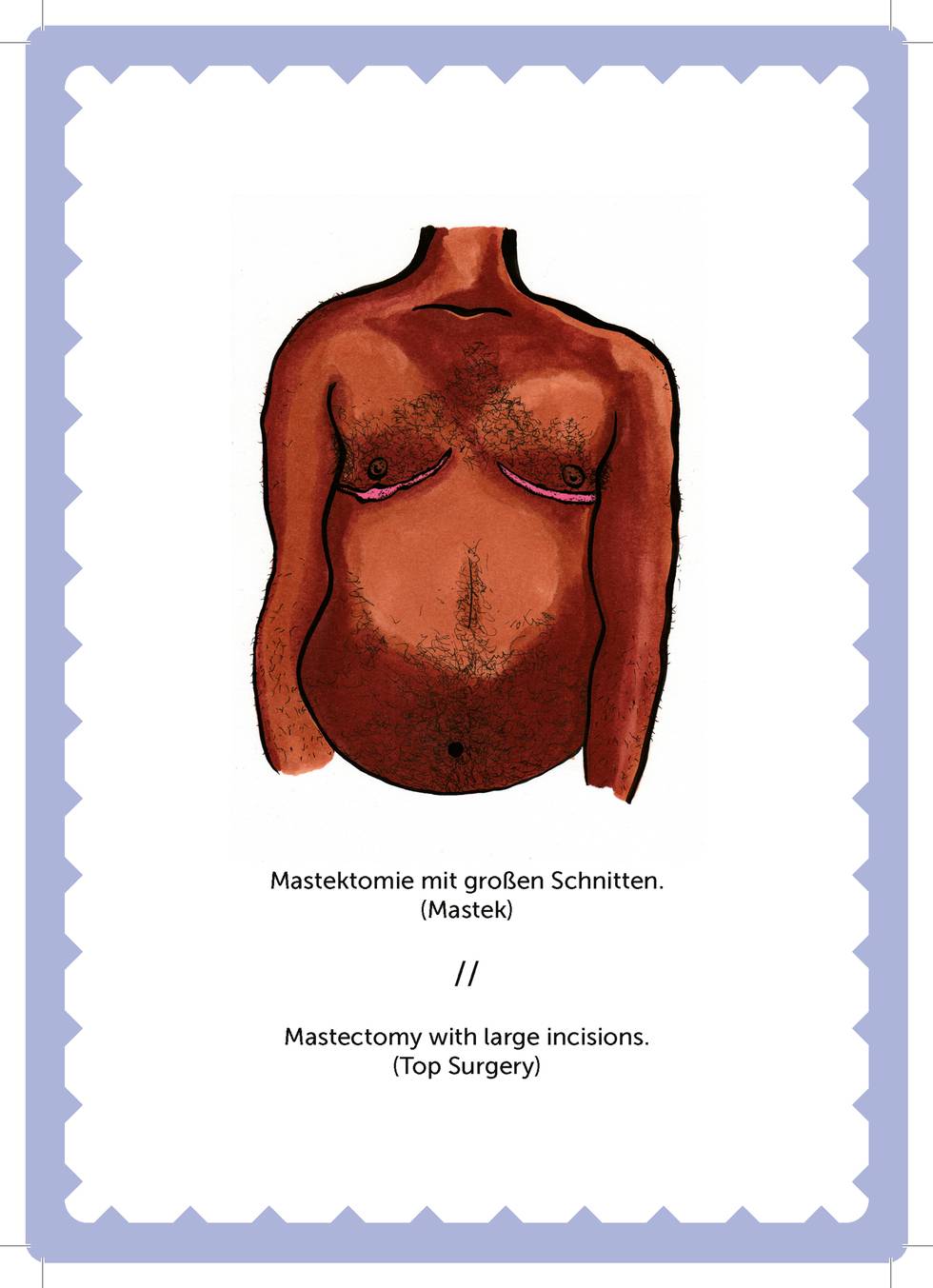 mastektomie-trans-non-binary-LGBTI-magazine-health-gesundheit.jpg mastektomie-trans-non-binary-LGBTI-magazine-health-gesundheit.jpg